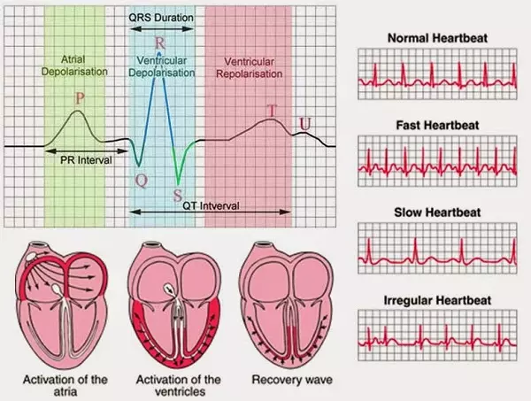 ECG Là Gì? Tìm Hiểu Về Điện Tâm Đồ Trong Chẩn Đoán Tim Mạch ECG Là Gì? Tìm Hiểu Về Điện Tâm Đồ Trong Chẩn Đoán Tim Mạch