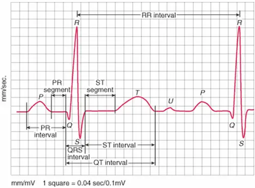 Ý Nghĩa Sóng P, QRS và T trong điện tim là gì? Ý Nghĩa Sóng P, QRS và T trong điện tim là gì?