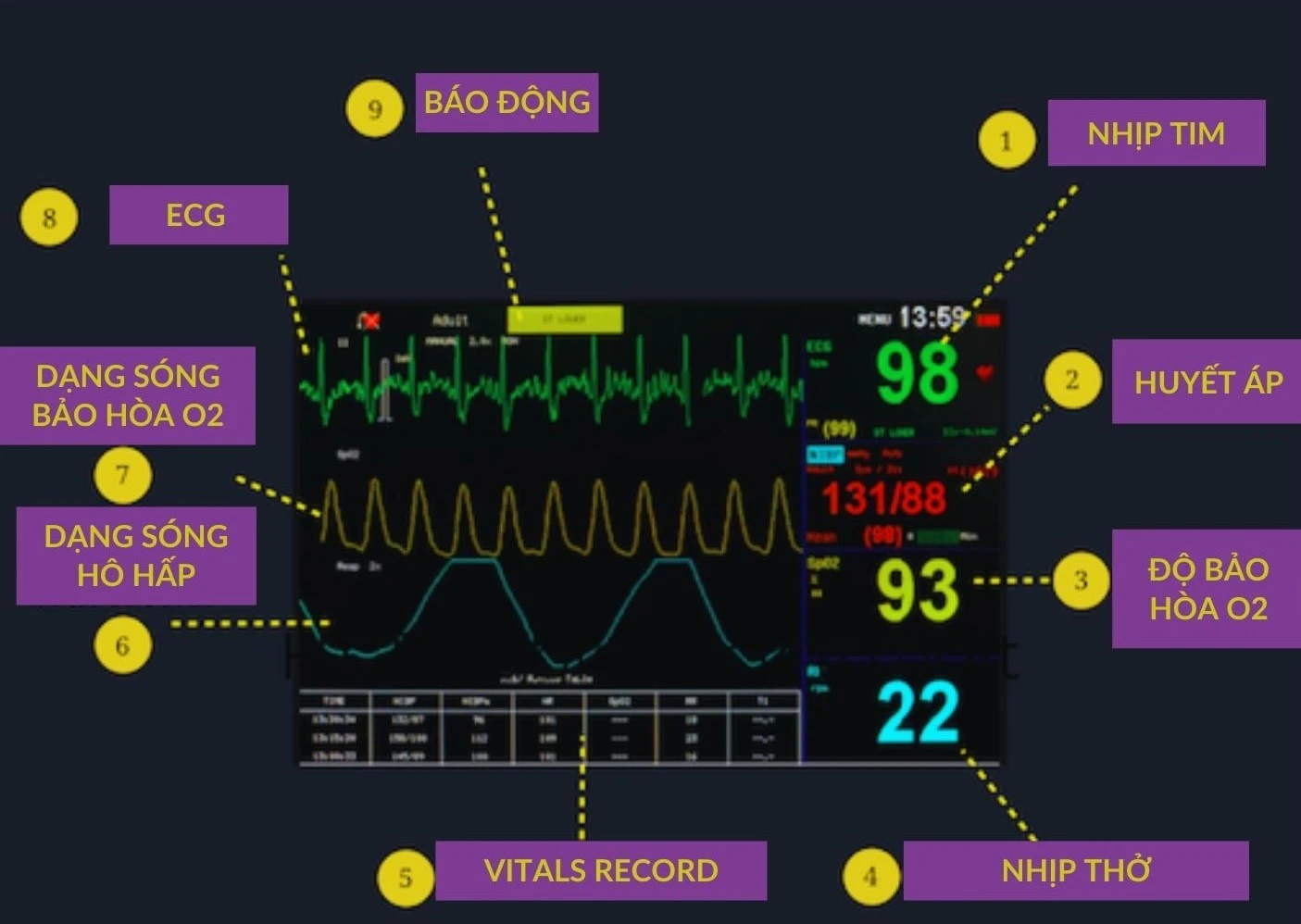 Các chỉ số quan trọng trên điện tâm đồ Các chỉ số quan trọng trên điện tâm đồ